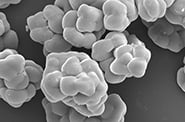 img_polymerization-catalyst